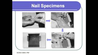 إختبار Tuberculin ،المسحة الشرجية ،عينات الأظافر، سرعة النزف والتجلط Sampling Part V [upl. by Mufi]