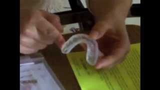 ProDental 3in1 Mouth Guard Review [upl. by Anaeco483]