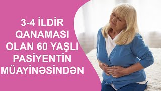 34 İLDİR QANAMASI OLAN 60 YAŞLI PASİYENTİN MÜAYİNƏSİNDƏN [upl. by Hteb53]