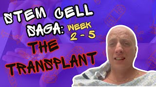 STEM CELL SAGA The Transplant  HARDEST thing I’ve ever done [upl. by Stelu]