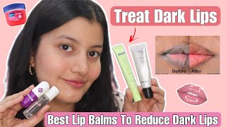 FINALLY Found The Best Lip Balms To Lighten DARK LIPS [upl. by Jordanna]