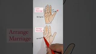 Intercaste Love Marriage I अंतरजातीय प्रेम विवाह I Love Arranged Marriage Palmistry Astro Arun [upl. by Aihselef]