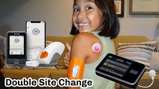 Dexcom G6 amp Tandem Tslim x2 Insertion  Type One Diabetes [upl. by Mayman]