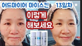 💯어드마이아마이스킨 요렇게만 하세요기미주근깨검버섯 없애기 admire my skin  기본이 중요 너무 이것저것 바르지 않기 우리 피부재생을 믿어봐요 [upl. by Ycart]