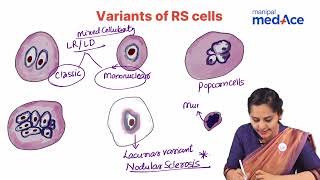 Hodgkin Lymphoma Pathology Explained  Dr Ranjana Ranade  Manipal MedAce Exam Prep [upl. by Suelo]