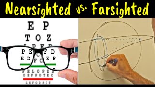 Myopia vs Hyperopia vs Presbyopia  Difference Explained [upl. by Necaj]