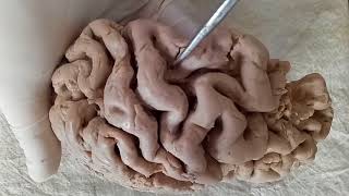 NEUROANATOMY  CEREBRAL CORTEX PART1 SULCI AND GYRI  BY DR MITESH DAVE [upl. by Gambell]