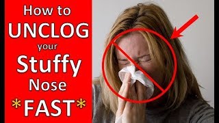 How to UNCLOG Your STUFFY Nose FAST My PROVEN Method for UNBLOCKING Sinuses Quickly [upl. by Watkins]