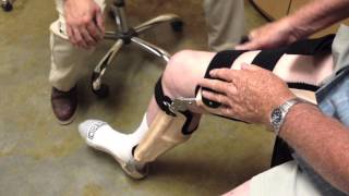 Orthotics and Prosthetics  Medicine Biomechanics and Design [upl. by Phenice]