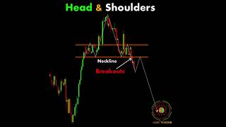 Head and Shoulders chartpatterns forex trading shorts reels [upl. by Oetam]