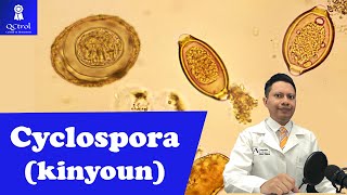 Conoce a Cyclospora cayetanensis con tinción de KINYOUN [upl. by Edyth]