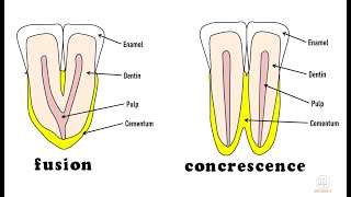 Developmental disturbances in shape of teeth  Part 1 [upl. by Tterraj]