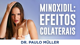 Minoxidil Efeitos Colaterais  Dr Paulo Müller Dermatologista [upl. by Theresita]