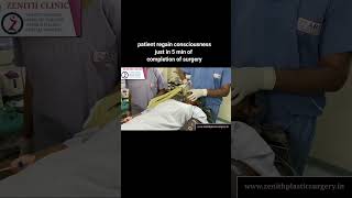 GENERAL ANAESTHESIA IN SURGERY ANAESTHESIA FOR RHINOPLASTY AND BREAST SURGERYZENITH CLINIC INDIA [upl. by Enrobialc]