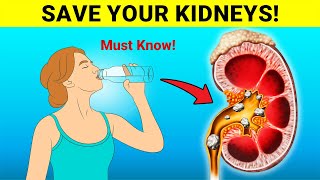 Top 8 Habits To Heal Your Kidneys and Prevent Kidney Stones [upl. by Gerri]