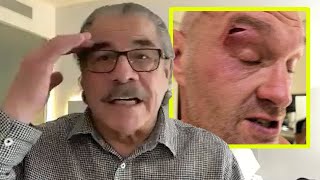 TYSON FURY NEEDS A WORLDCLASS CUTMAN  Legendary Stitch Duran READY TO HELP vs Usyk [upl. by Yerd358]