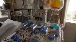 Bone Marrow Transplant Patient Information Chapter 2  Bone Marrow Transplants [upl. by Isola496]