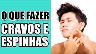 🔴 O QUE FAZER COM AS ESPINHAS E CRAVOS feat EI ANDREW  PELE MASCULINA [upl. by Anselme882]