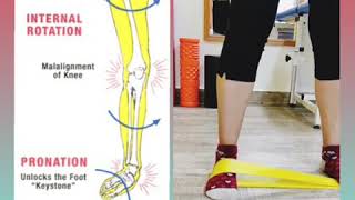 Foot pronation correction [upl. by Attenyw]