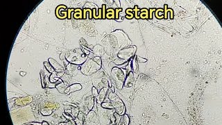 Granular starch in Stool sample stooltest stoolanalysis stoolexamination فحص الخروج [upl. by Foulk]