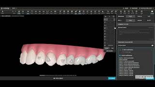 Improve your Invisalign results by reducing root torque [upl. by Madra233]