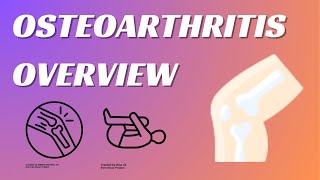 Osteoarthritis Overview Symptoms Diagnosis and Management  Orthopedics Video 1 [upl. by Ykcir]