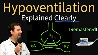 Hypoventilation and Hypoxemia Explained Clearly  Remastered [upl. by Ennazor]