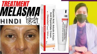 Melasma treatment HINDI Demelan cream reviewDr Malanbi [upl. by Gaspar]