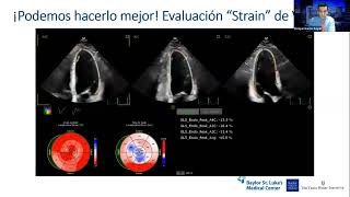 Webinar FAC Estenosis aórtica moderada y severa asintomática ¿son todas iguales [upl. by Morna]