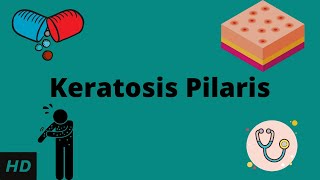 Keratosis Pilaris Causes Signs and Symptoms Diagnosis and Treatment [upl. by Yrannav]