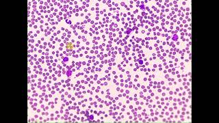 Crenated RBCs WBCs Pig Blood smear [upl. by Ajin]