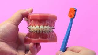 CURAPROX Ortho Ultra Soft  แปรงสีฟันสำหรับคนจัดฟัน [upl. by Yelrebmik]