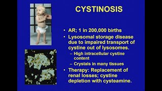 Cystinosis Basics with Dr Bill Gahl [upl. by Ioyal191]