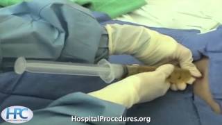 Paracentesis Procedure Video Trailer [upl. by Amoihc]