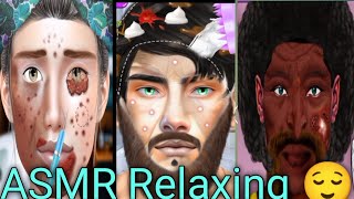 ASMR Relaxing treatment acne remove eye treatment wound remove surgery relaxing [upl. by Dorwin]