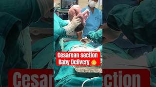 Cesarean section baby deliverynewbornviral [upl. by Jillayne325]