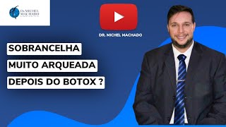 Como diminuir a sobrancelha muito arqueada depois do Botox [upl. by Irac]