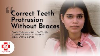 Correct Teeth Protrusion Without Braces  Cosmetic Dentist In Mumbai  SAPTeeth [upl. by Aynodal]