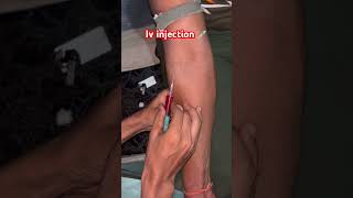 Iv injection viralvideo li [upl. by Naillik745]