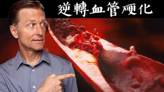 血管硬化原因？修復血管硬化的營養素！自然療法柏格醫生 Dr Berg [upl. by Toll]