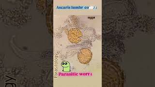 Ascariasis👍eggs👍Parasitology👍📚🔬✅ [upl. by Cinemod]