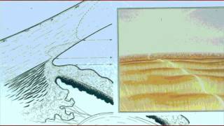 Full Lecture Basic Gonioscopy [upl. by Annavoeg]