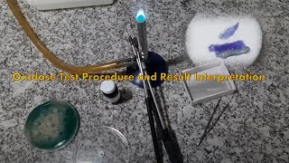 Oxidase Test Procedure and Result Interpretation [upl. by Yenreit468]