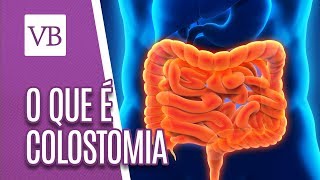 O que é Colostomia  Você Bonita 310119 [upl. by Reklaw136]