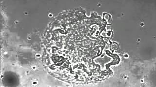 Megakaryocyte and platelet formation [upl. by Allie]