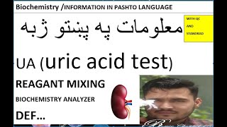 uric acid test in pashto [upl. by Illah468]