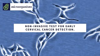 Noninvasive urine test for early cervical cancer detection🔬 [upl. by Nileuqcaj859]