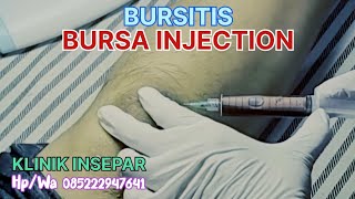 BURSITIS  BURSA INJECTION  ruralhealthcare syarhan [upl. by Sandra810]