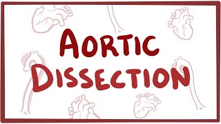 Aortic Dissection  causes symptoms diagnosis treatment pathology [upl. by Victorine54]