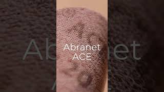 Abranet Ace  the original net abrasive✨shorts foryou bestabrasives [upl. by Baram]